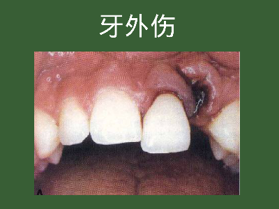在线考试系统